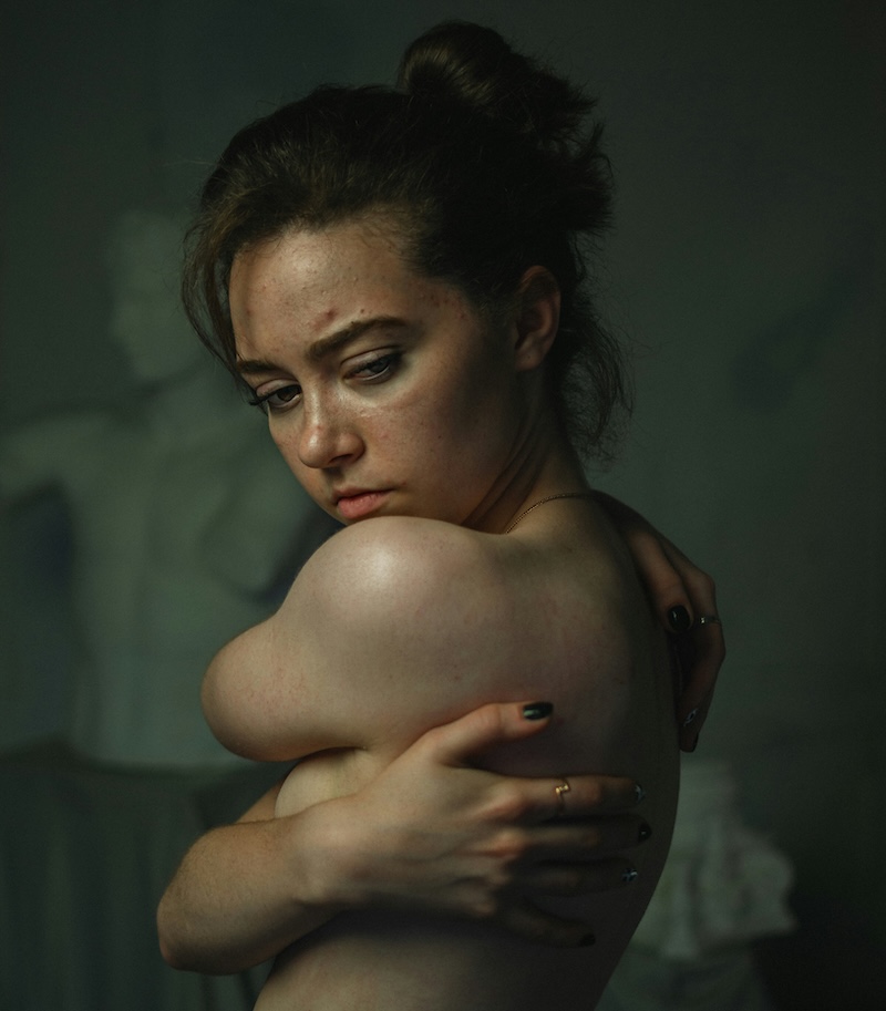 Body image issues therapy